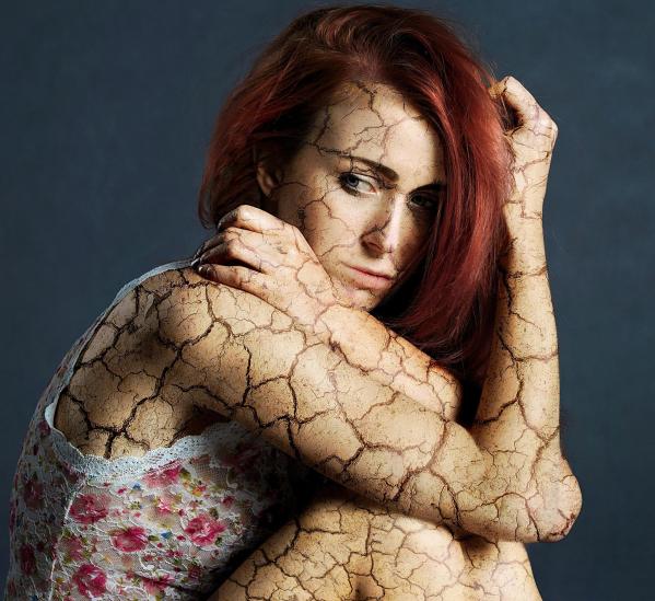 L'hypnose aide les comportements de scarification, troubles émotionnels à la rochelle